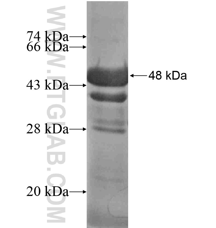 CCDC80 fusion protein Ag16699 SDS-PAGE