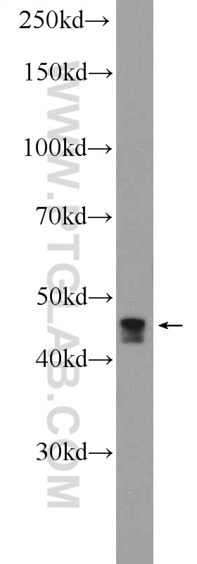 WB analysis of Jurkat using 20902-1-AP