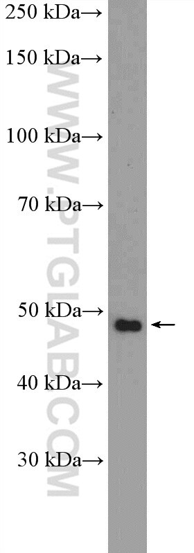 Western Blot (WB) analysis of Jurkat cells using CCDC83 Polyclonal antibody (20902-1-AP)