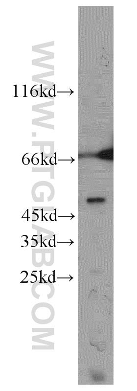 Western Blot (WB) analysis of Jurkat cells using CCDC83 Polyclonal antibody (20902-1-AP)