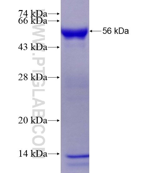 CCDC83 fusion protein Ag28480 SDS-PAGE
