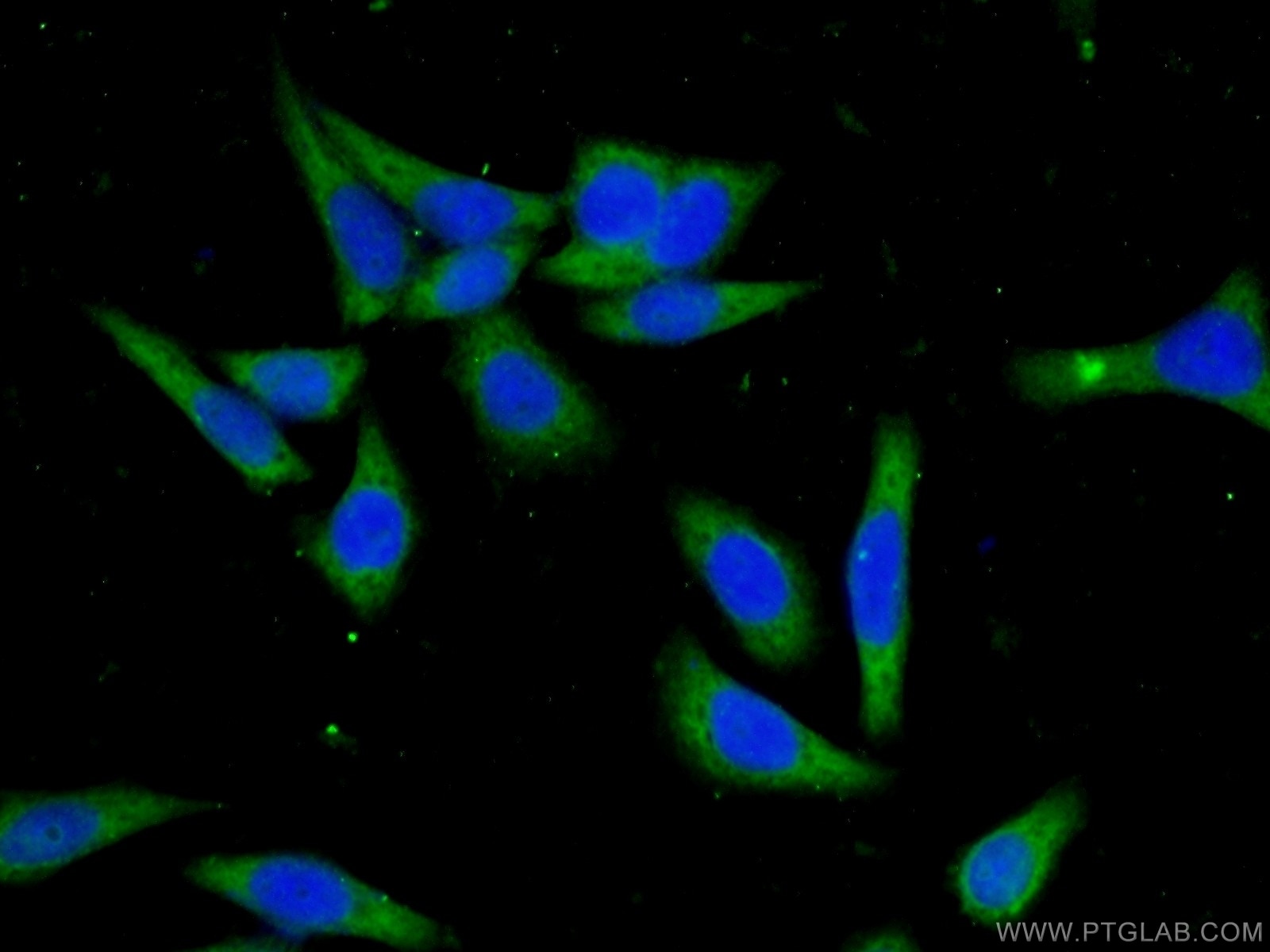 Immunofluorescence (IF) / fluorescent staining of HeLa cells using CCDC85B Polyclonal antibody (18282-1-AP)