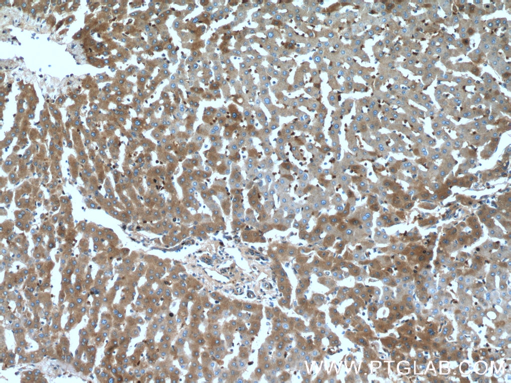 Immunohistochemistry (IHC) staining of human liver tissue using CCDC85B Polyclonal antibody (18282-1-AP)
