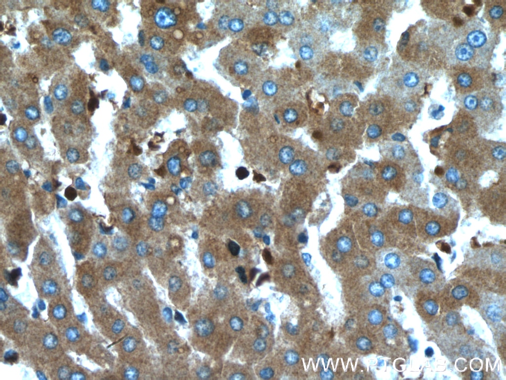 Immunohistochemistry (IHC) staining of human liver tissue using CCDC85B Polyclonal antibody (18282-1-AP)