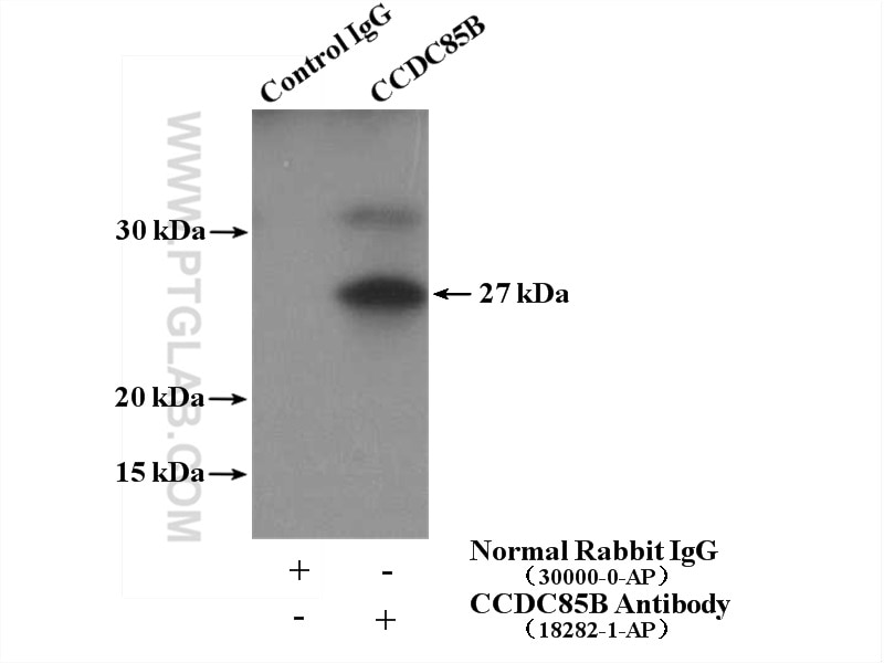 Immunoprecipitation (IP) experiment of mouse heart tissue using CCDC85B Polyclonal antibody (18282-1-AP)