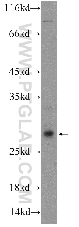 Western Blot (WB) analysis of mouse lung tissue using CCDC85B Polyclonal antibody (18282-1-AP)