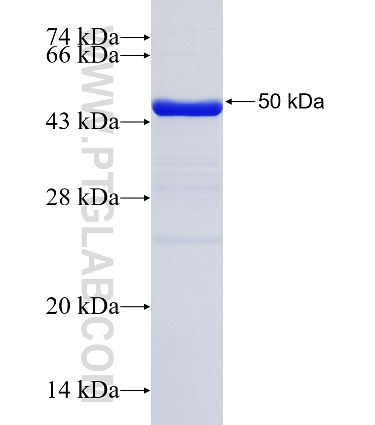CCDC85C fusion protein Ag35157 SDS-PAGE CCDC85C fusion protein Ag35157 SDS-PAGE