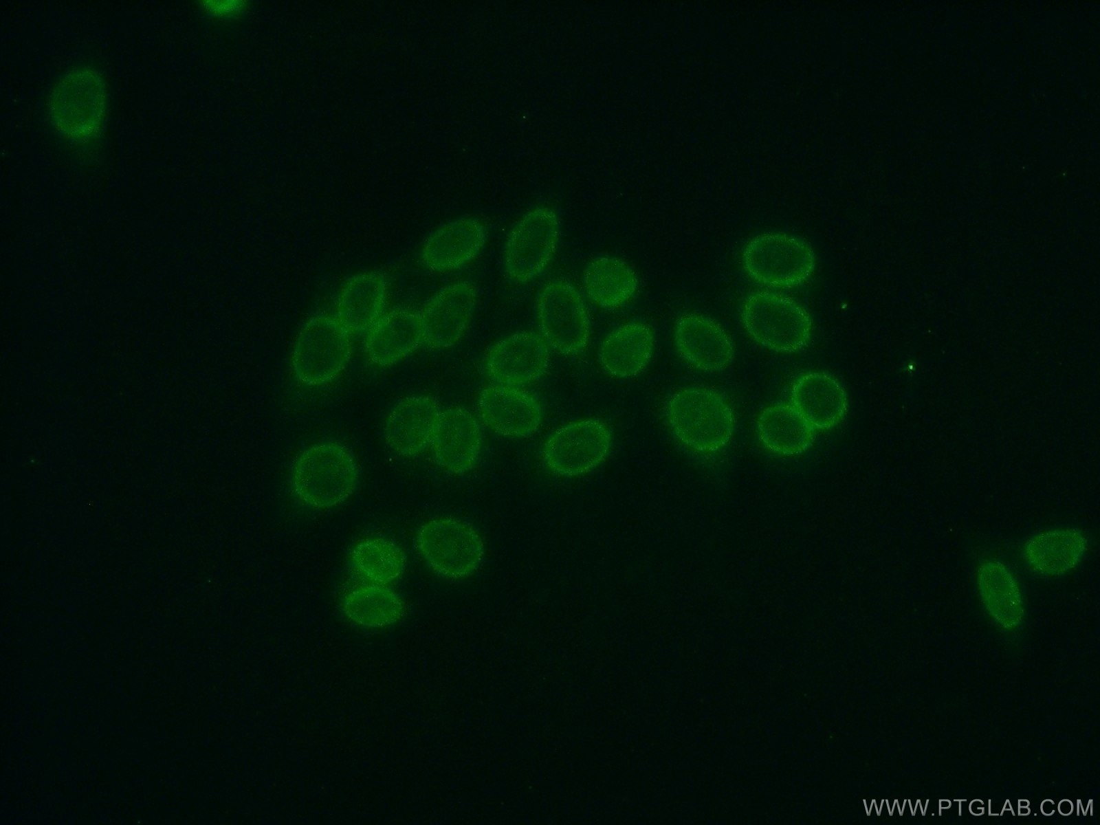 Immunofluorescence (IF) / fluorescent staining of HepG2 cells using Cyclon/CCDC86 Polyclonal antibody (14947-1-AP)
