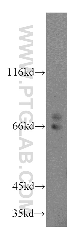 Western Blot (WB) analysis of human heart tissue using Cyclon/CCDC86 Polyclonal antibody (14947-1-AP)