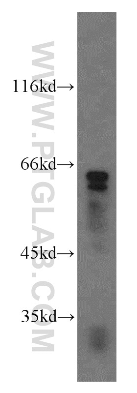 Western Blot (WB) analysis of human liver tissue using Cyclon/CCDC86 Polyclonal antibody (14947-1-AP)