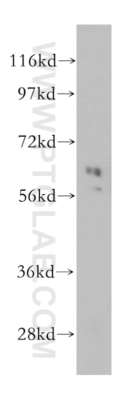 Western Blot (WB) analysis of HepG2 cells using Cyclon/CCDC86 Polyclonal antibody (14947-1-AP)