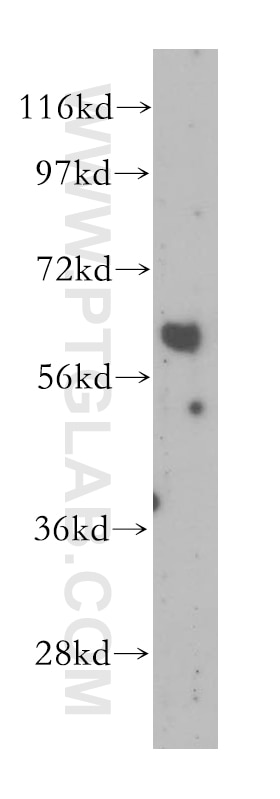 Western Blot (WB) analysis of human stomach tissue using Cyclon/CCDC86 Polyclonal antibody (14947-1-AP)
