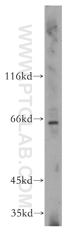 Western Blot (WB) analysis of HepG2 cells using Cyclon/CCDC86 Polyclonal antibody (14947-1-AP)