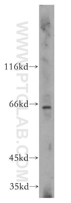 WB analysis of HepG2 using 14947-1-AP