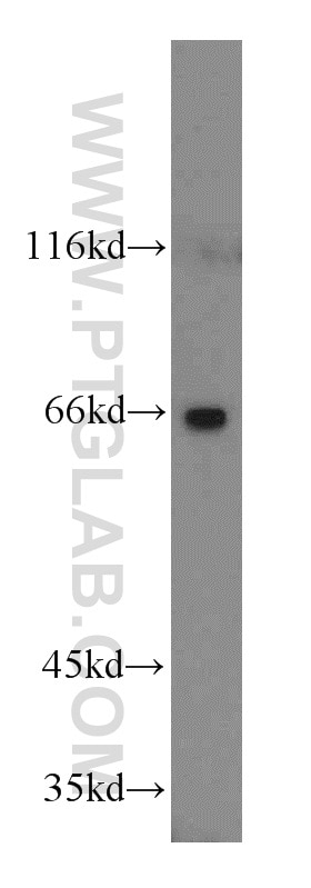 Western Blot (WB) analysis of mouse stomach tissue using Cyclon/CCDC86 Polyclonal antibody (14947-1-AP)