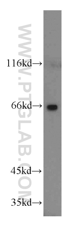 WB analysis of mouse stomach using 14947-1-AP