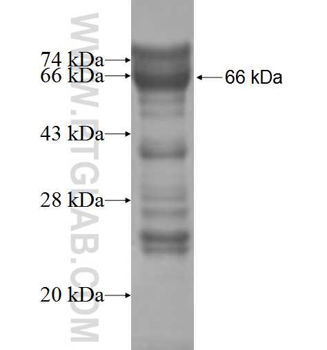 CCDC86 fusion protein Ag7333 SDS-PAGE