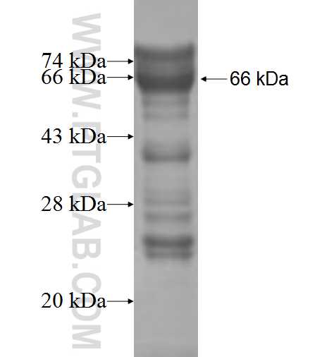CCDC86 fusion protein Ag7333 SDS-PAGE CCDC86 fusion protein Ag7333 SDS-PAGE
