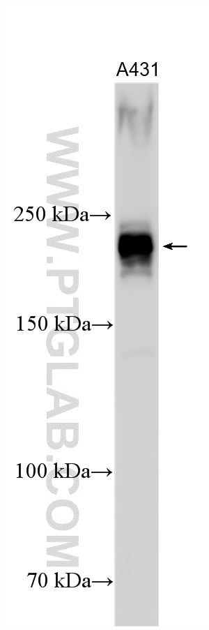 Western Blot (WB) analysis of various lysates using CCDC88A Polyclonal antibody (33569-1-AP)