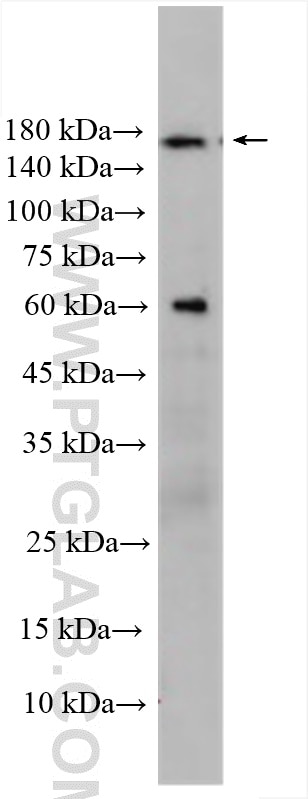 Western Blot (WB) analysis of Raji cells using CCDC88B Polyclonal antibody (20871-1-AP)
