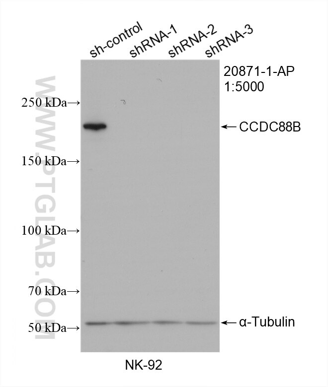 Western Blot (WB) analysis of NK-92 cells using CCDC88B Polyclonal antibody (20871-1-AP)