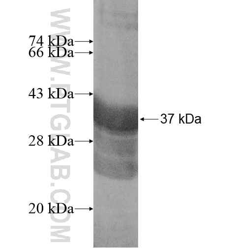 CCDC88B fusion protein Ag14936 SDS-PAGE