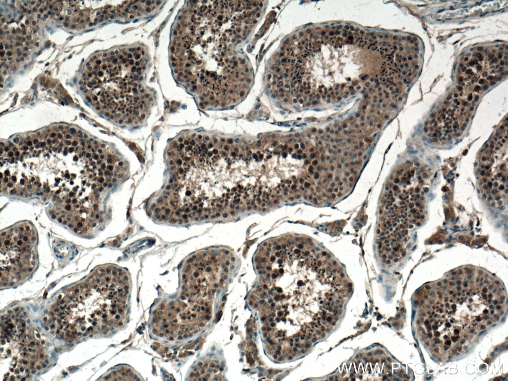 Immunohistochemistry (IHC) staining of human testis tissue using CCDC88C Polyclonal antibody (25769-1-AP)
