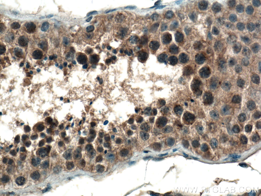 Immunohistochemistry (IHC) staining of human testis tissue using CCDC88C Polyclonal antibody (25769-1-AP)