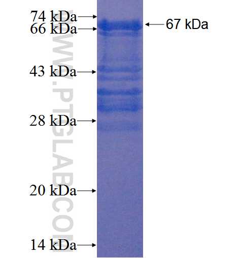 CCDC88C fusion protein Ag22711 SDS-PAGE