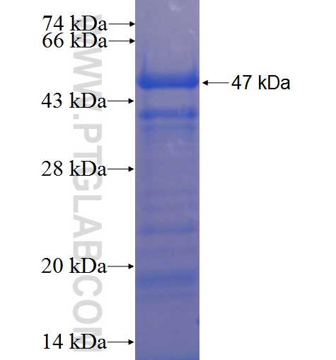 CCDC88C fusion protein Ag22788 SDS-PAGE