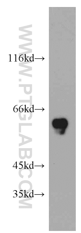 Western Blot (WB) analysis of HeLa cells using CCDC9 Polyclonal antibody (21104-1-AP)