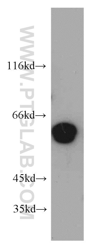 Western Blot (WB) analysis of HepG2 cells using CCDC9 Polyclonal antibody (21104-1-AP)