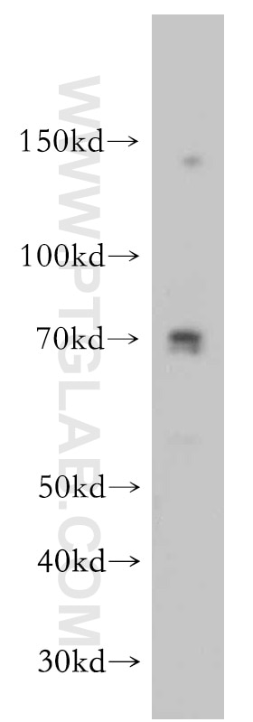 Western Blot (WB) analysis of human skeletal muscle tissue using CCDC9 Polyclonal antibody (21104-1-AP)