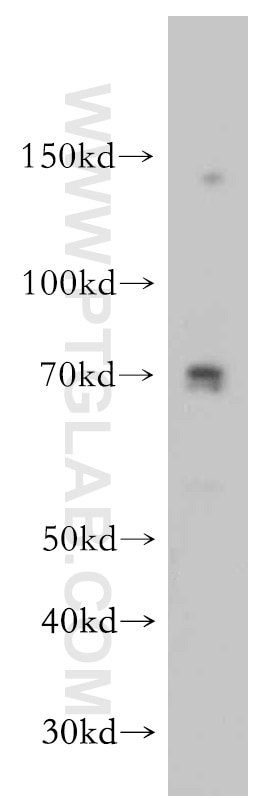 WB analysis of human skeletal muscle using 21104-1-AP