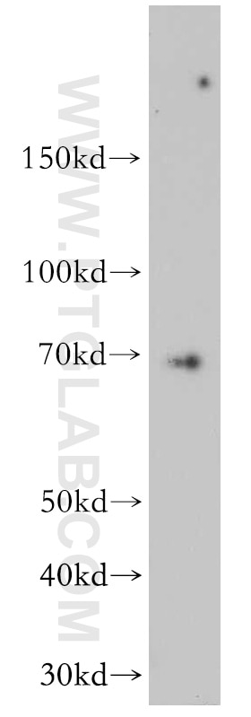 Western Blot (WB) analysis of mouse small intestine tissue using CCDC9 Polyclonal antibody (21104-1-AP)