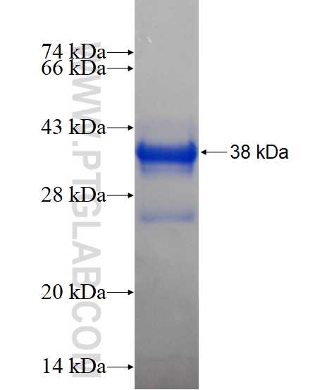 CCDC9 fusion protein Ag15374 SDS-PAGE