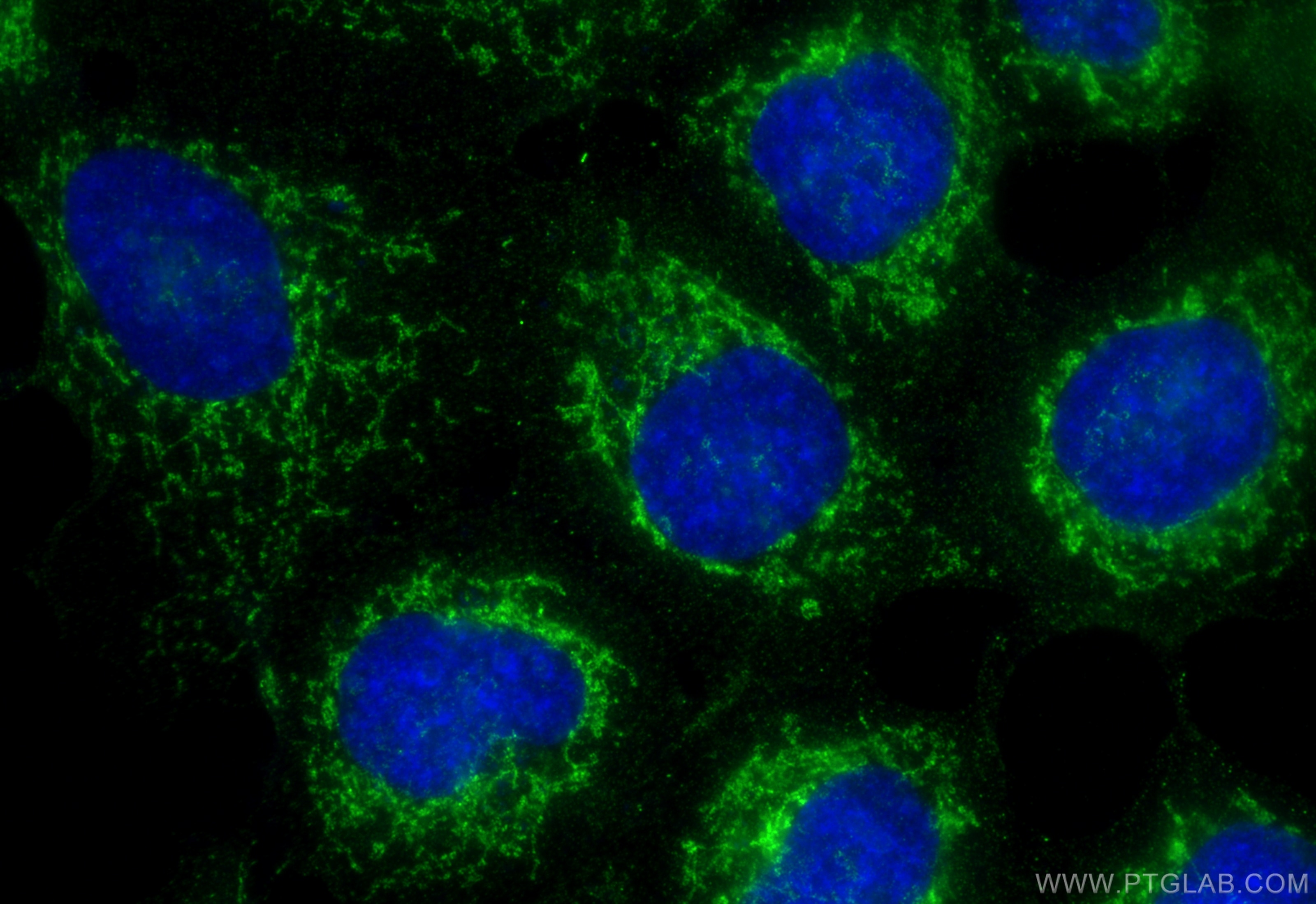 Immunofluorescence (IF) / fluorescent staining of A431 cells using CCDC90B Polyclonal antibody (27126-1-AP)