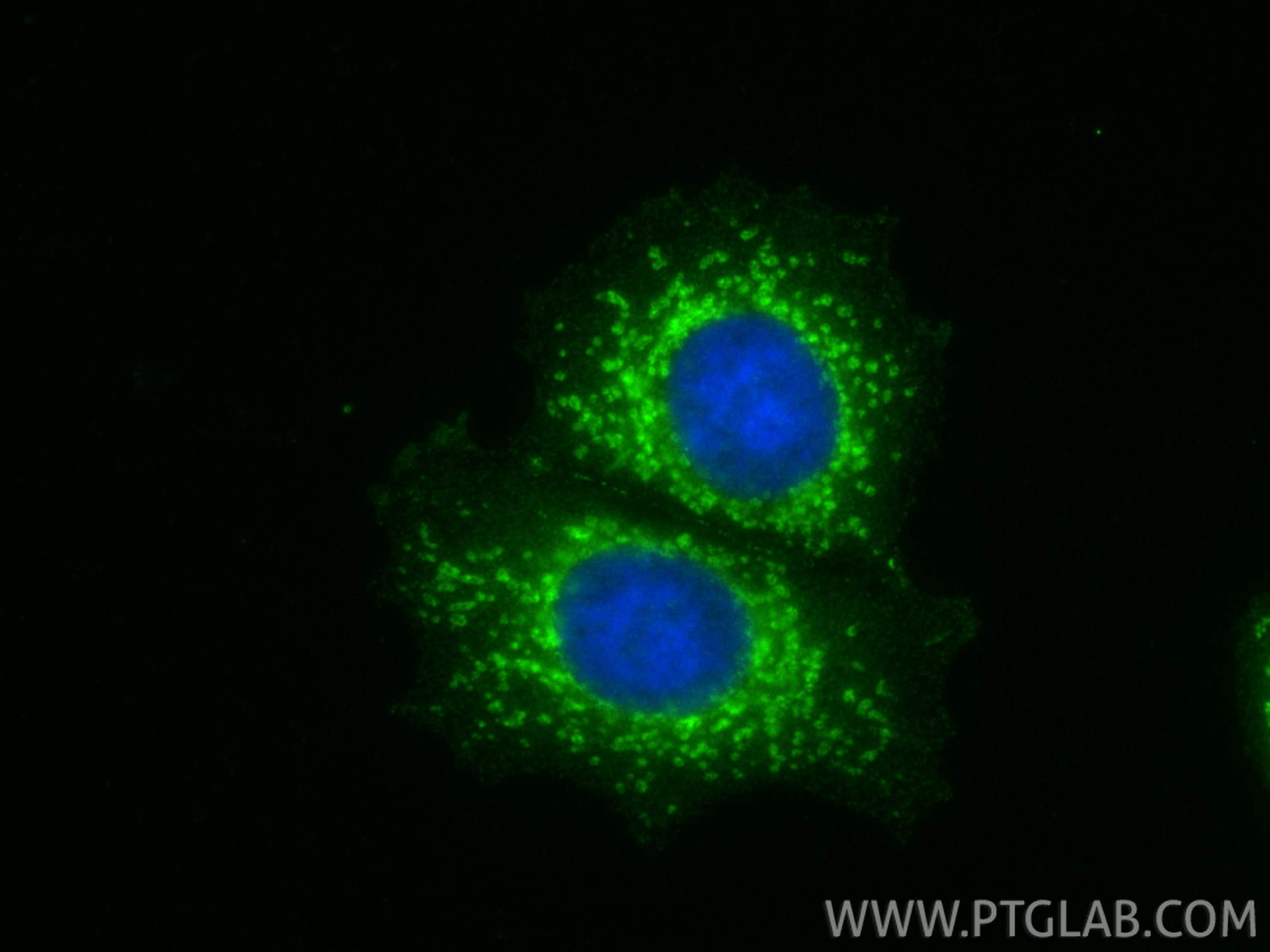 Immunofluorescence (IF) / fluorescent staining of MCF-7 cells using CCDC90B Polyclonal antibody (27126-1-AP)