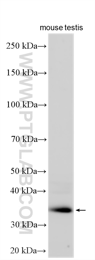 Western Blot (WB) analysis of various lysates using CCDC92 Polyclonal antibody (27192-1-AP)