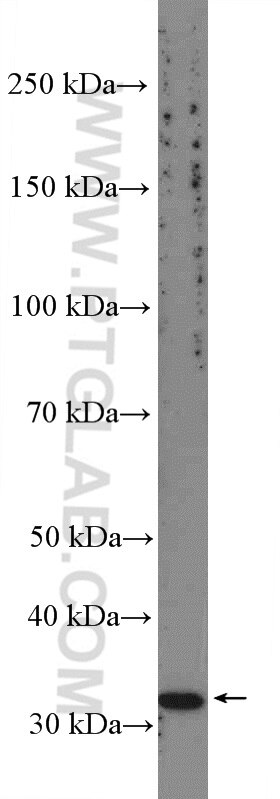 Western Blot (WB) analysis of mouse testis tissue using CCDC92 Polyclonal antibody (27192-1-AP)