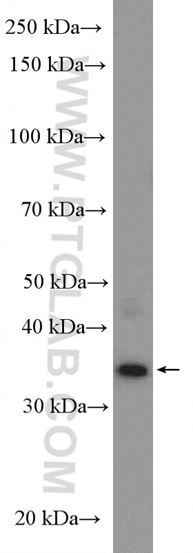 Western Blot (WB) analysis of rat testis tissue using CCDC92 Polyclonal antibody (27192-1-AP)