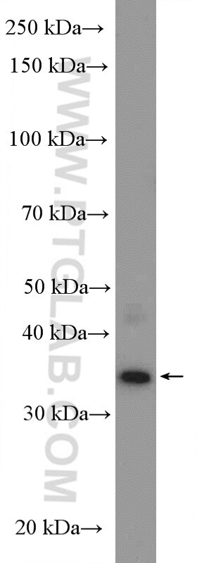 WB analysis of rat testis using 27192-1-AP