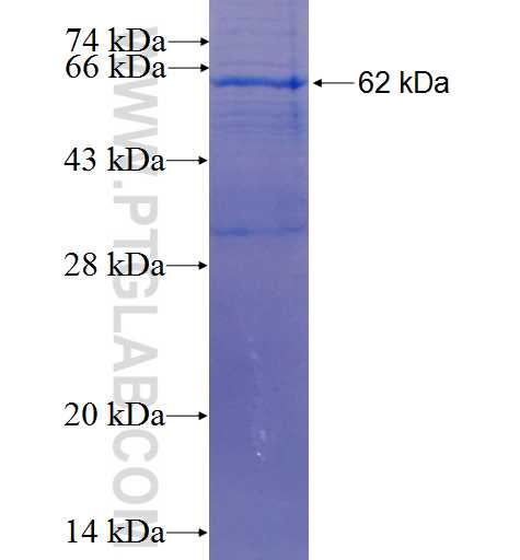 CCDC92 fusion protein Ag25606 SDS-PAGE