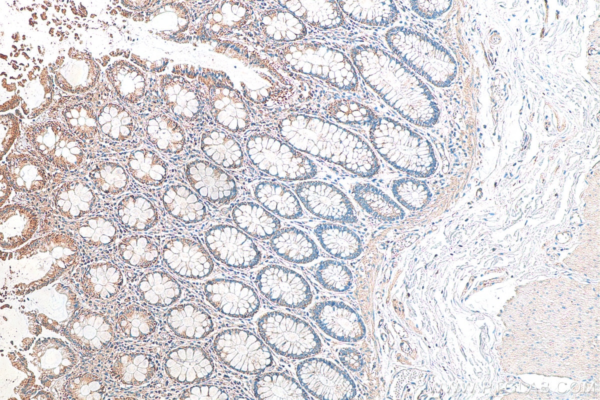 Immunohistochemistry (IHC) staining of human colon tissue using CCDC93 Polyclonal antibody (20861-1-AP)