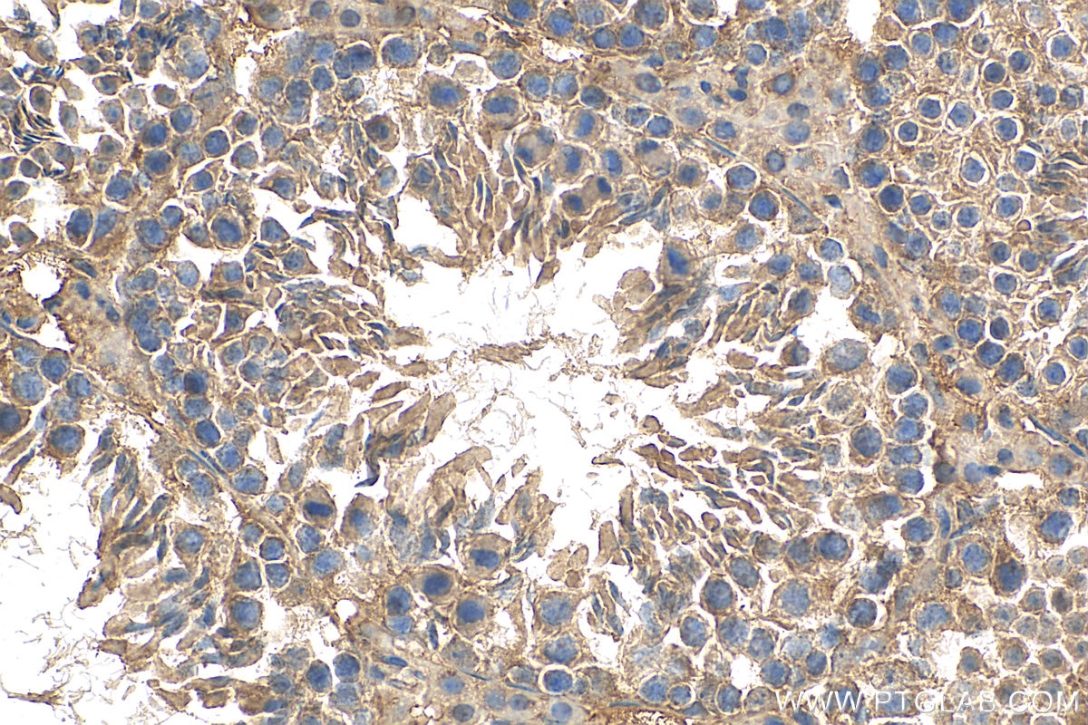 Immunohistochemistry (IHC) staining of mouse testis tissue using CCDC93 Polyclonal antibody (20861-1-AP)