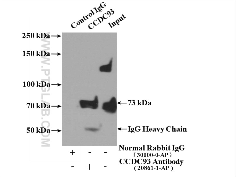 Immunoprecipitation (IP) experiment of L02 cells using CCDC93 Polyclonal antibody (20861-1-AP)