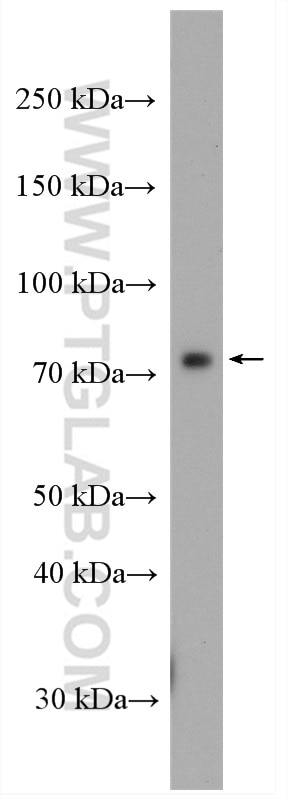 Western Blot (WB) analysis of mouse colon tissue using CCDC93 Polyclonal antibody (20861-1-AP)