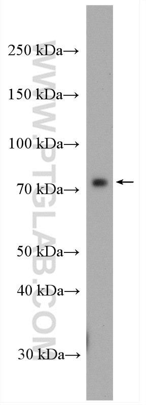 WB analysis of mouse colon using 20861-1-AP