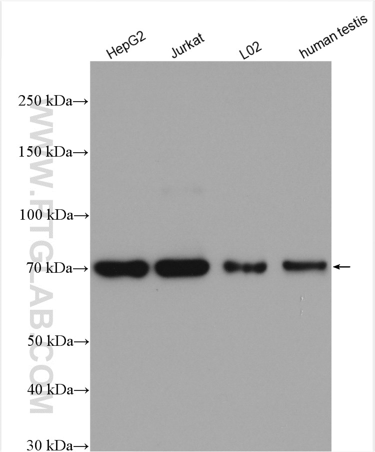 Western Blot (WB) analysis of various lysates using CCDC93 Polyclonal antibody (20861-1-AP)