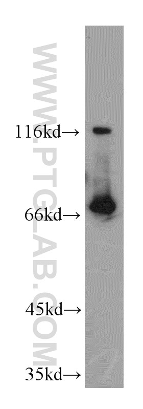 WB analysis of L02 using 20861-1-AP